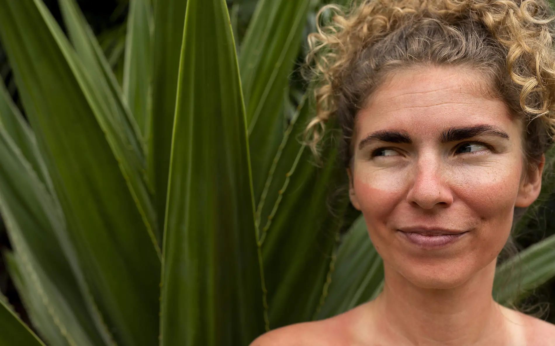 portrait-adult-woman-with-sunburn-skin