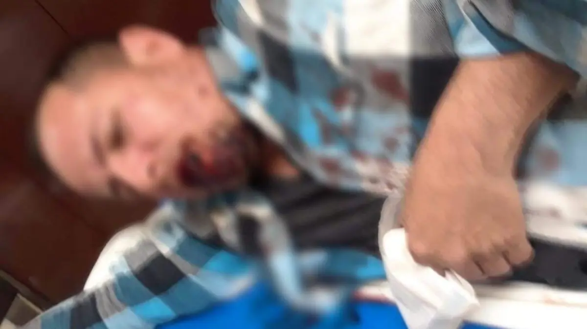 Investiga Fiscalía General agresión a reportero de RadioPatrulla