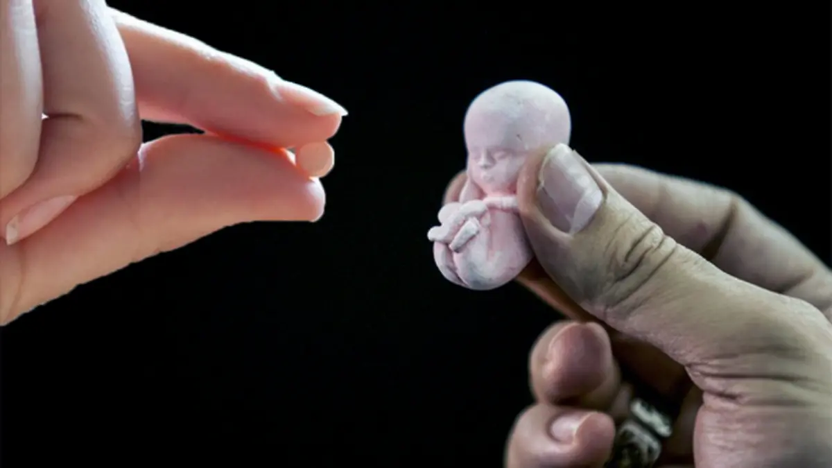 aborto
