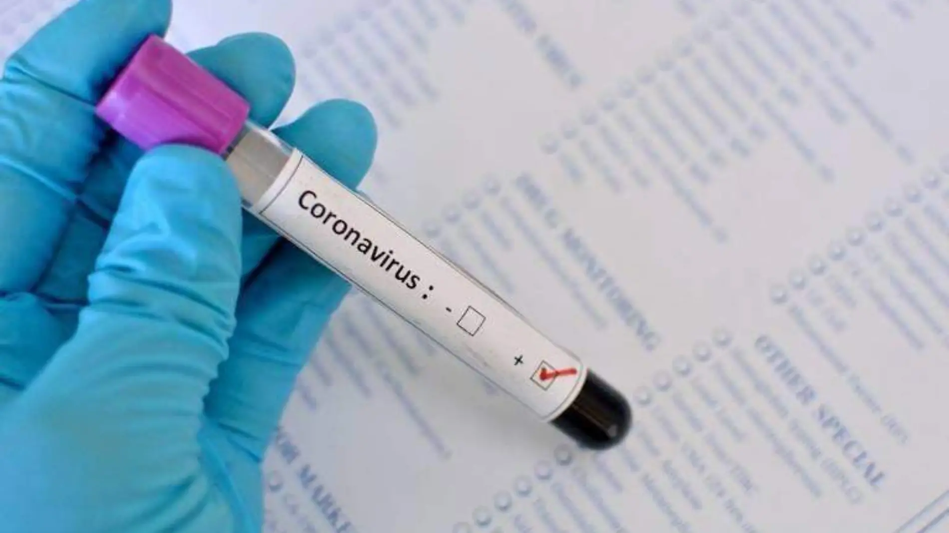 coronavirus