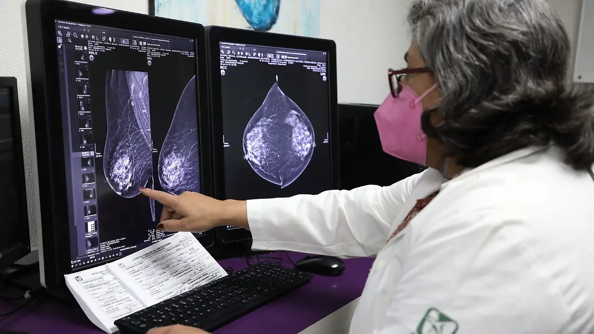 949948_IMSS Prevención Cáncer de Mama-4_impreso