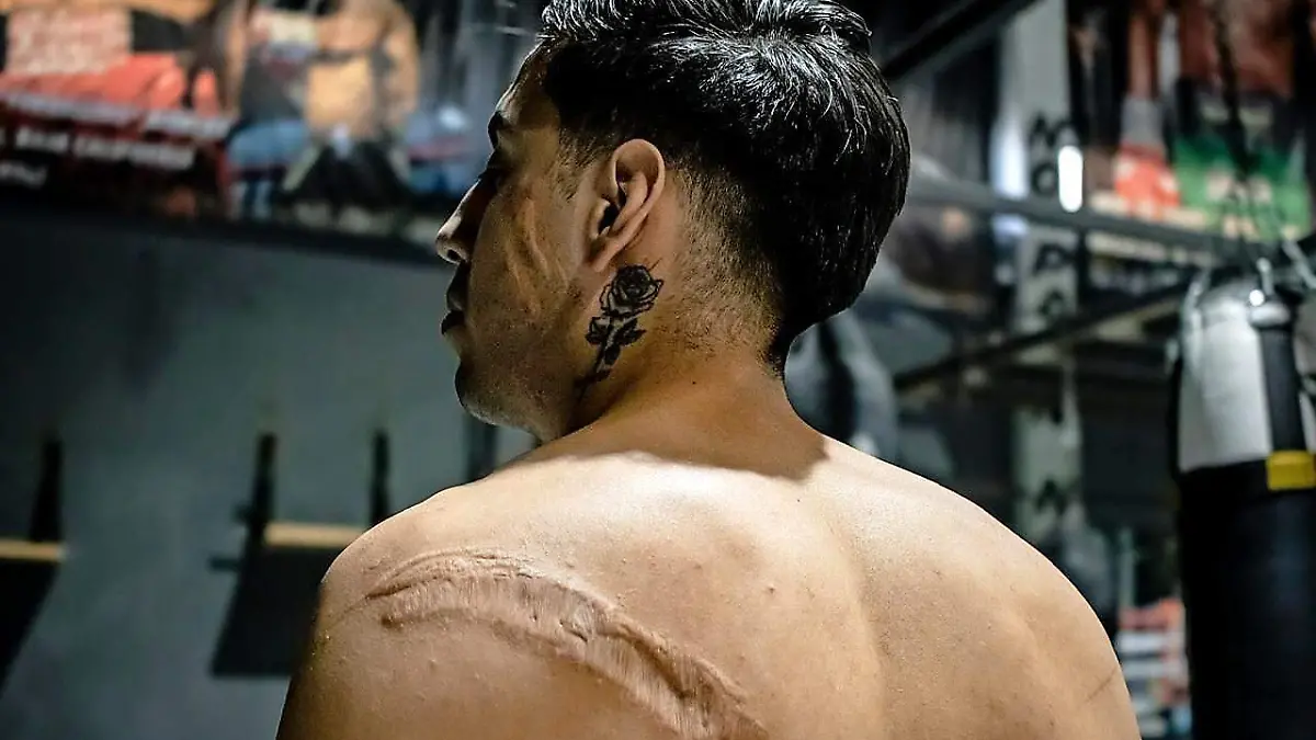 Con humildad y resiliencia, El Tigre quiere rugir de nuevo