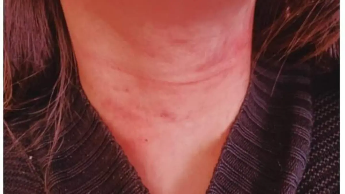 CORTESIA - AGRESION (5)