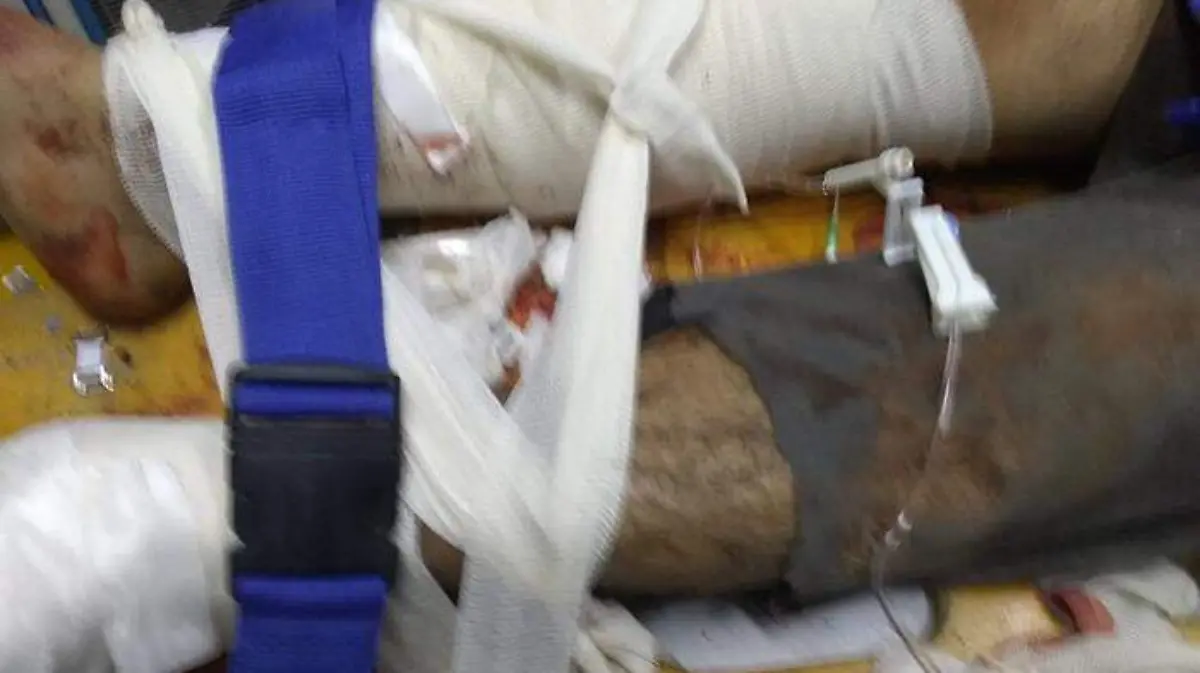 Calistro, de 45 años