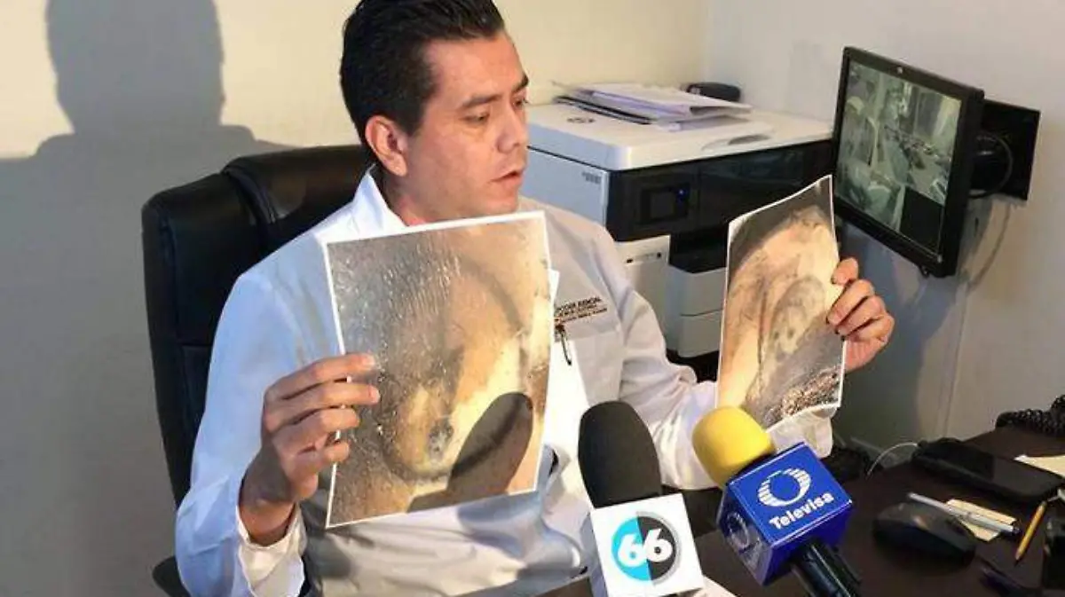 Cuerpo calcinado tenía 24 lesiones por arma punzocortante
